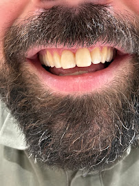No Gaps Dental Sydney CBD Wynyard