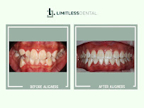 Limitless Dental