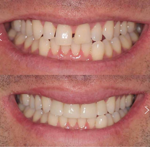 Teeth Plus Clinic Annandale