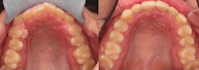 Teeth Plus Clinic Annandale
