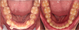 Teeth Plus Clinic Annandale