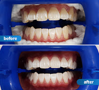 My Local Dentists Leichhardt