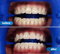 My Local Dentists Leichhardt