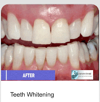 Garners Dental Marrickville