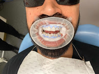 Smiles On Norton