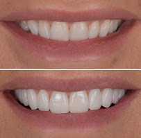 Dental Lounge Sydney CBD