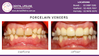 Bondi Dental Lifeline