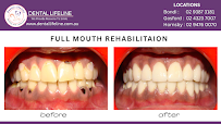 Bondi Dental Lifeline