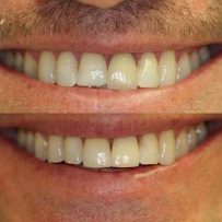 Mint Dental Care