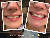 Affordable Dentist Te Atatu