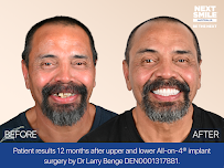 Next Smile Australia – All-on-4® Dental Implants Sydney