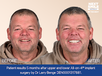 Next Smile Australia – All-on-4® Dental Implants Sydney
