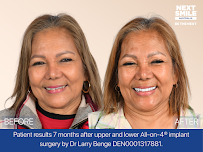 Next Smile Australia – All-on-4® Dental Implants Sydney