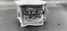 Designer Dentures