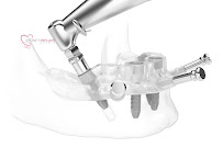 Sydney Implant Studio