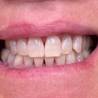 The Teeth Whitening Boutique - Bondi Junction