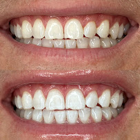 The Teeth Whitening Boutique - Bondi Junction