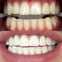 The Teeth Whitening Boutique - Bondi Junction