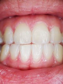 Whiterteeth Dental