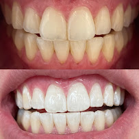 The Whitening Clinic