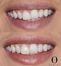 O Dental