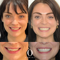 O Dental