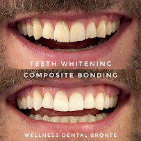 Wellness Dental Bronte