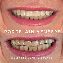 Wellness Dental Bronte