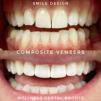 Wellness Dental Bronte
