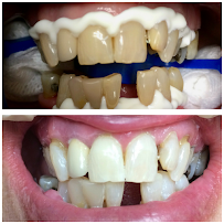 Just Smiles Dentistry Ashfield