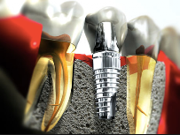 D-Zire Dental Centre