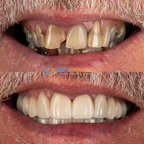 Value Dental Centres Sydney