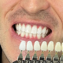Sydney Teeth Whitening