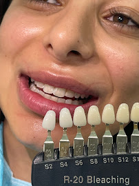 Sydney Teeth Whitening