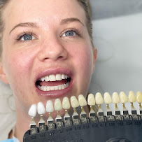 Sydney Teeth Whitening