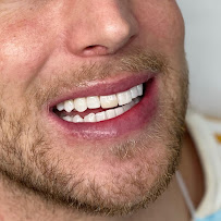 Sydney Teeth Whitening
