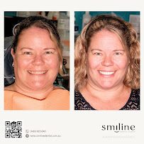 Smiline Dental