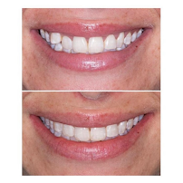 Smiline Dental