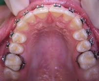 Every Smile Dental - Marrickville