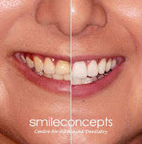 Smile Concepts