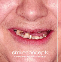 Smile Concepts