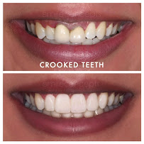 Smile Concepts