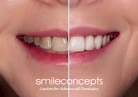 Smile Concepts