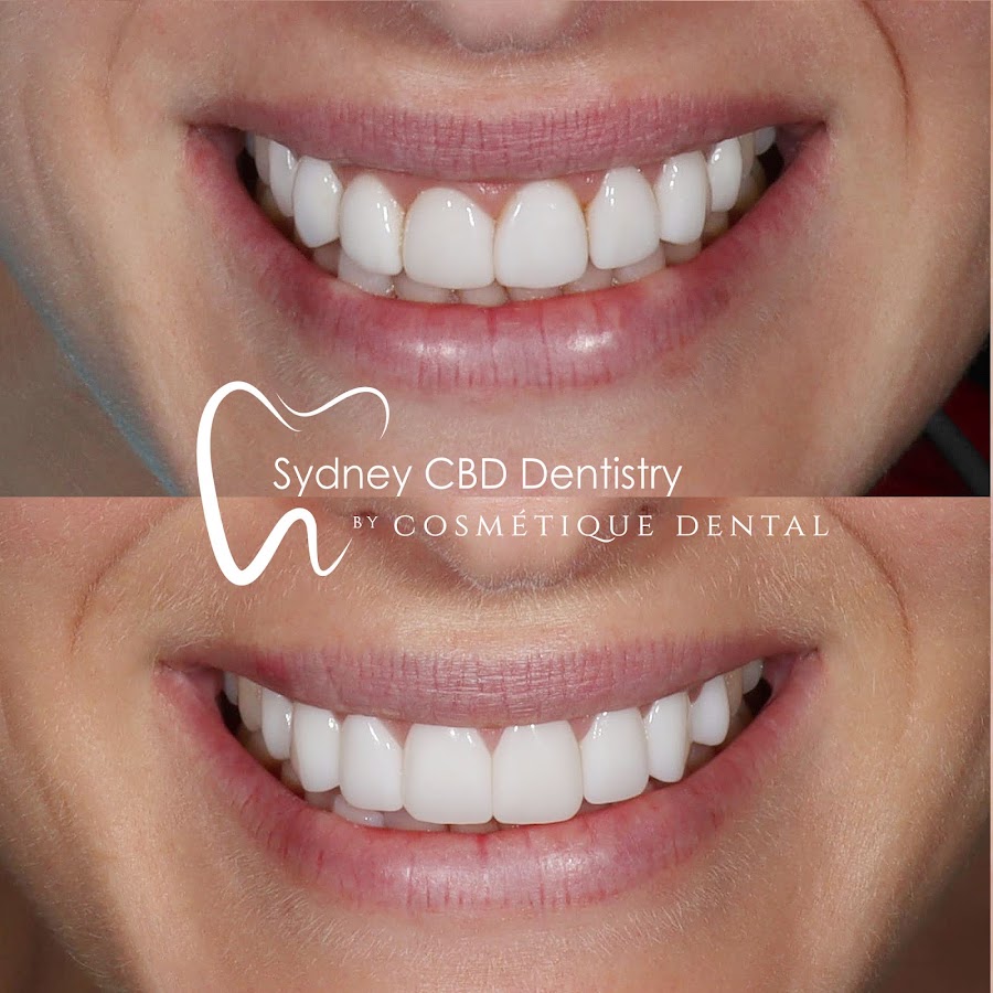 Sydney CBD Dentistry | Cosmetique Dental