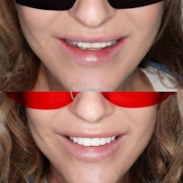 Sydney CBD Dentistry | Cosmetique Dental