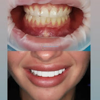 Sydney CBD Dentistry | Cosmetique Dental