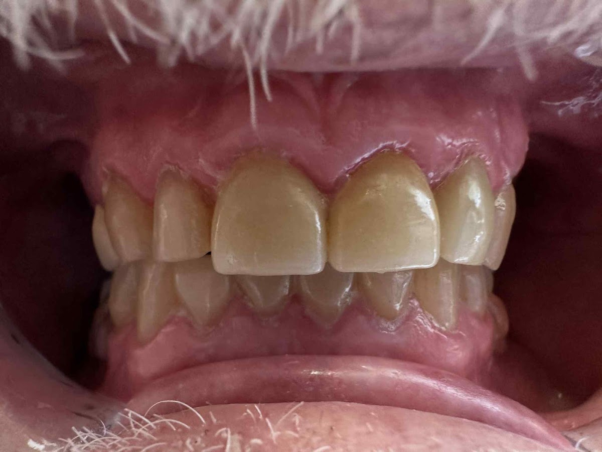 Precision Smiles Dental Lab