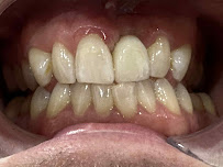 Precision Smiles Dental Lab