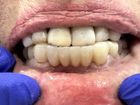 Precision Smiles Dental Lab