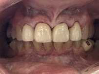 Precision Smiles Dental Lab
